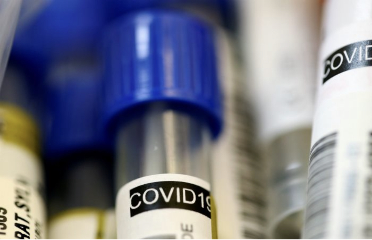В России испытания вакцины от коронавируса на животных закончатся к концу апреля.